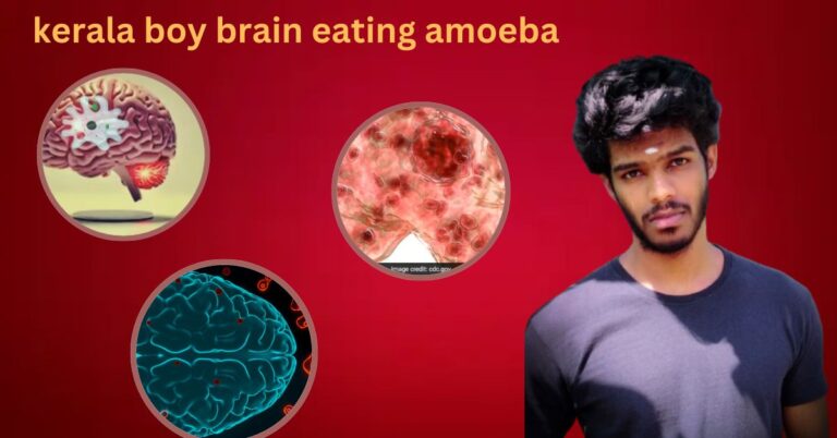 kerala boy brain eating amoeba